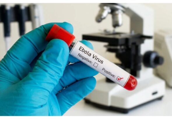 Ebola